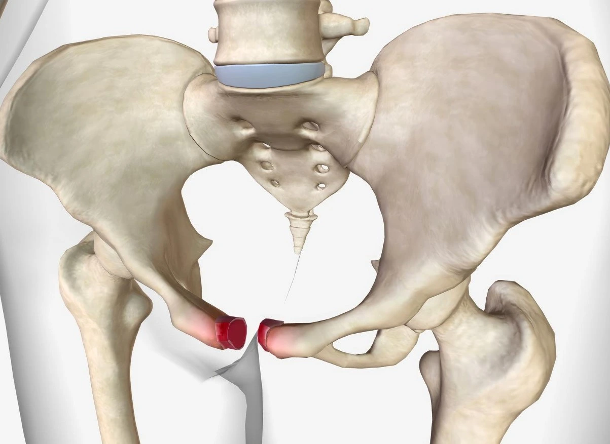 hip surgery in indore, orthopedic surgeon in indore, best orthopedic doctor indore