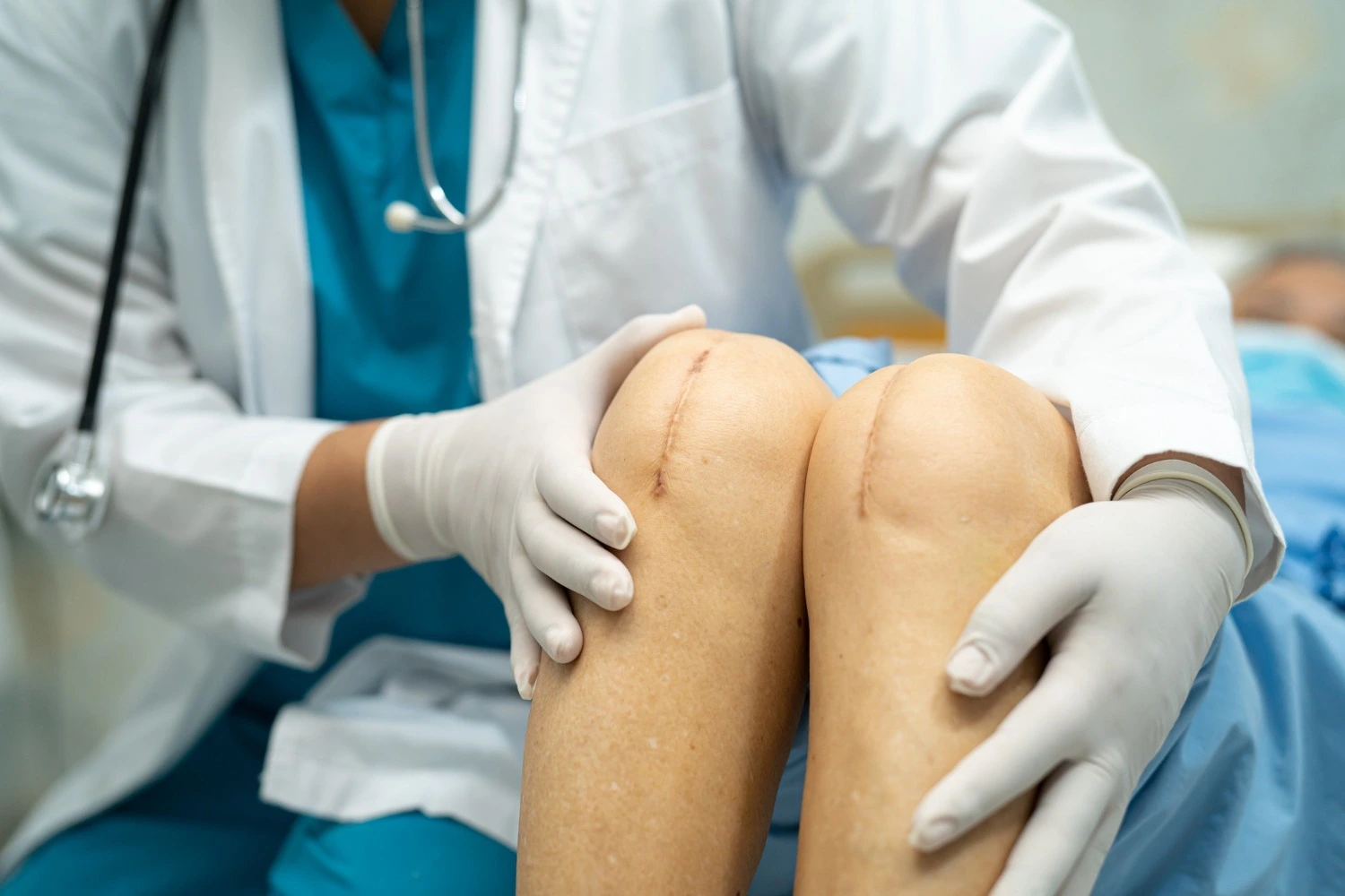 arthroscopic knee surgery in indore, knee replacement surgery in indore, knee replacement surgeon in indore